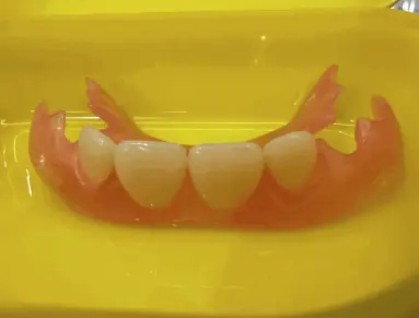 活動假牙