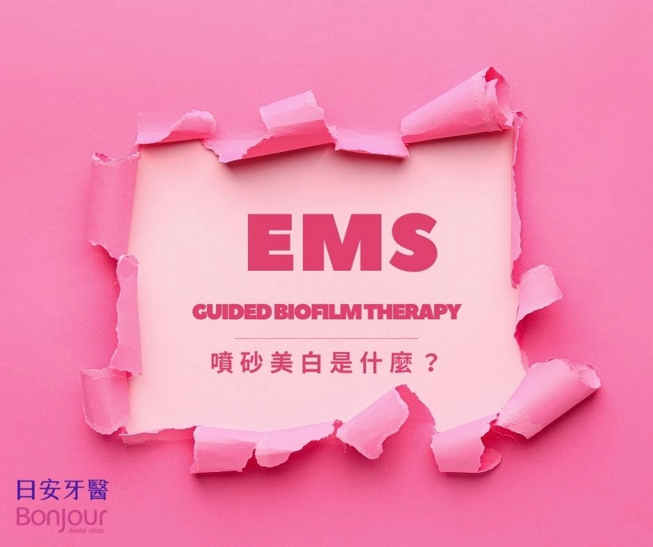 🏆 【日安獨家】瑞士 EMS 噴砂科技 x 台灣專業技術：打造竹北頂級舒適潔牙體驗！