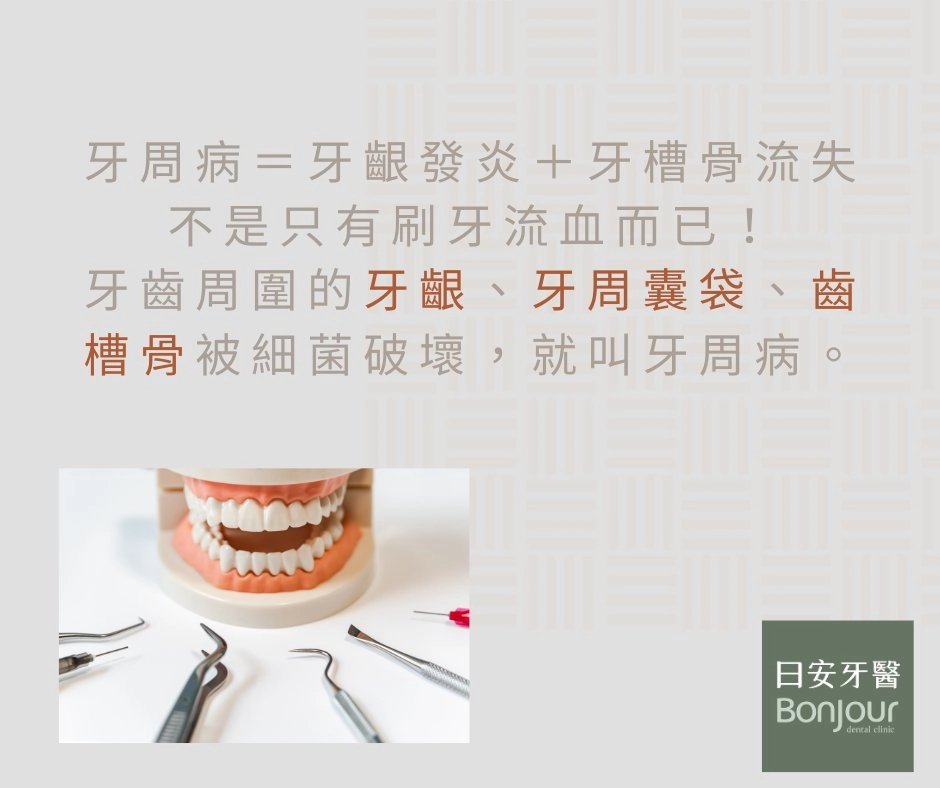 🦷 牙周病不是老人病！現在 20–30 歲也很常見