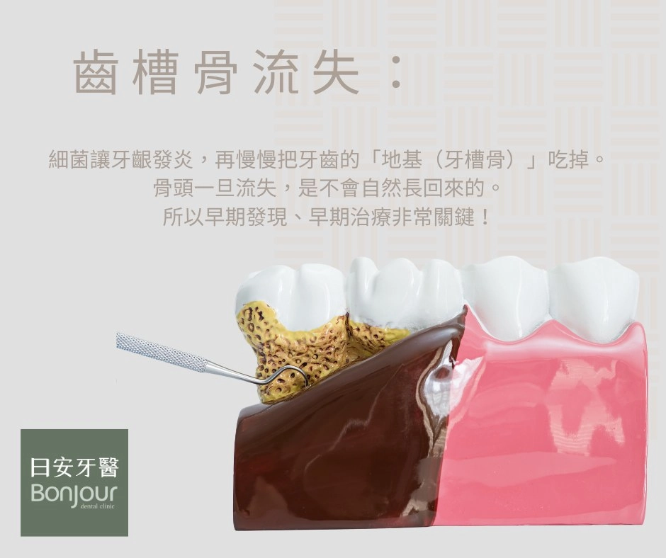 🦷 牙周病不是老人病！現在 20–30 歲也很常見
