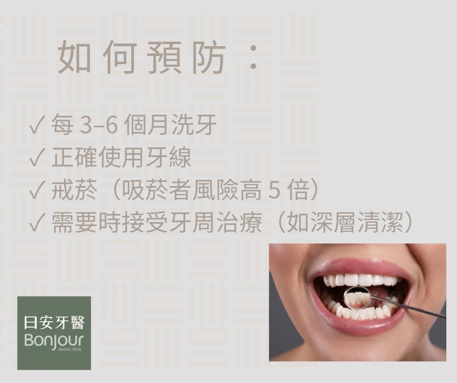 🦷 牙周病不是老人病！現在 20–30 歲也很常見